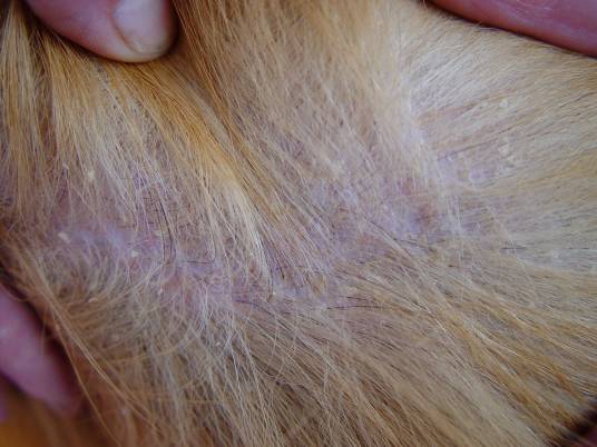 失禁相关性皮炎