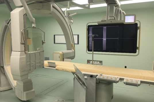 数字减影血管造影