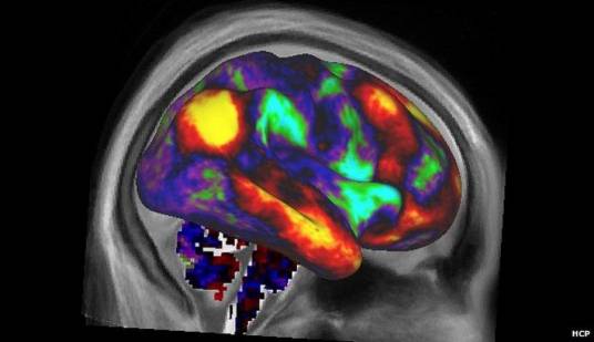 右脑（人体器官）