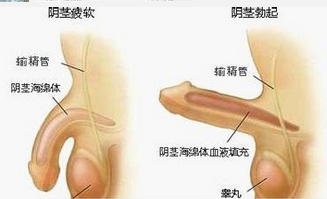 射精障碍性不育
