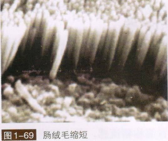 猪轮状病毒感染