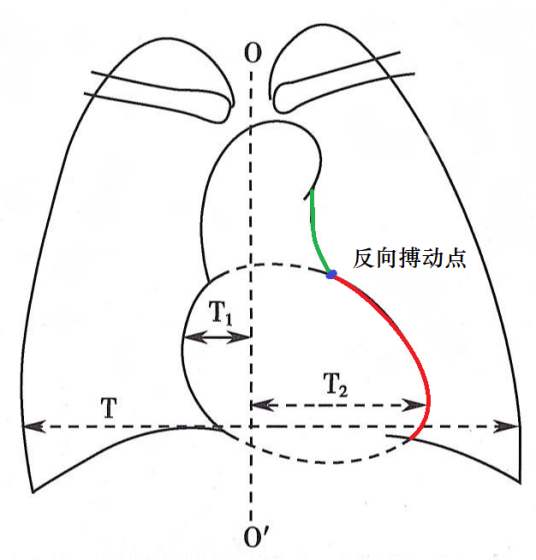 相反搏动点