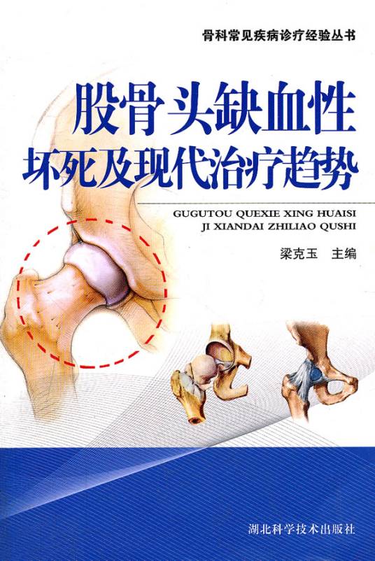 股骨头缺血性坏死及现代治疗趋势