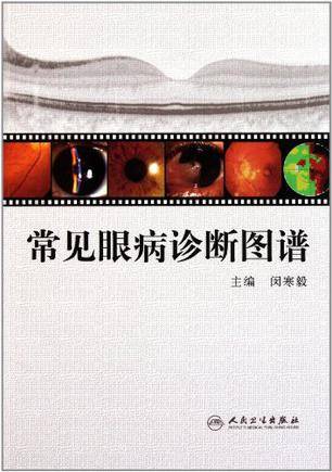 常见眼病诊断图谱