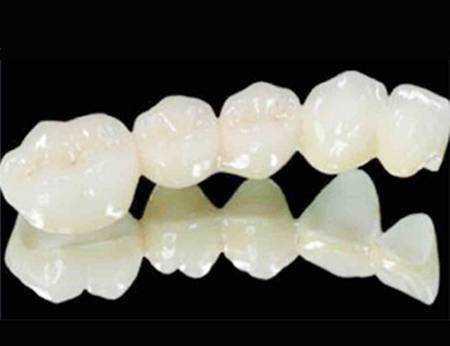 二氧化铝全瓷牙