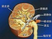 多发性骨髓瘤肾病