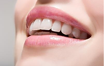 皓齿美白