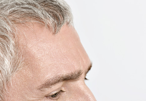 额头皱纹突然增加