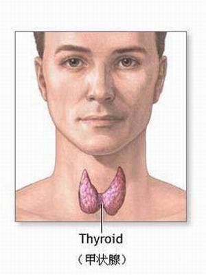 甲状腺激素抵抗综合症