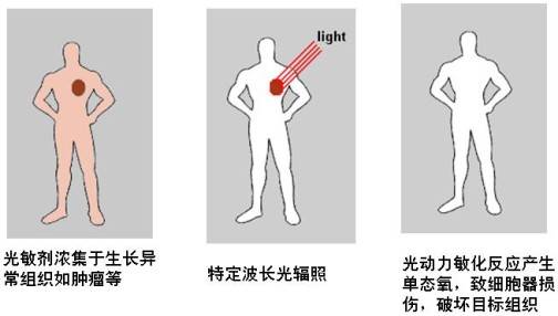 光动力学