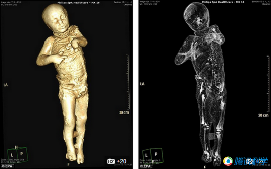 庞贝古城木乃伊