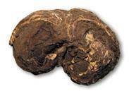 结核(地质学名词)