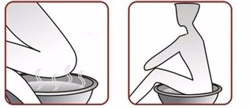 怎样用无花果巧治痔疮？