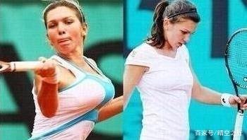 真拼，为了冠军进行缩胸手术，哈勒普手术后战绩如何？