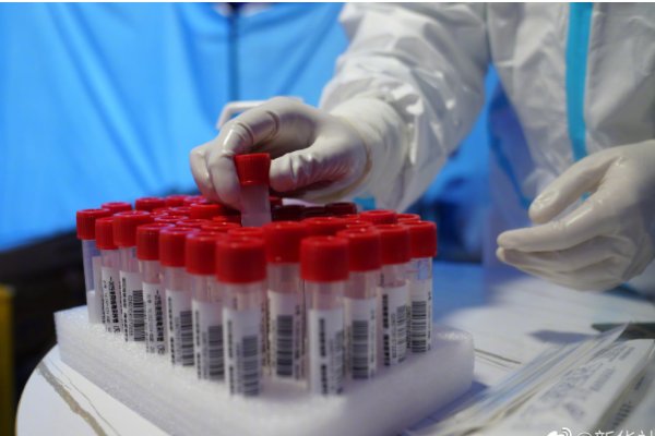 宁波发现3例核酸阳性人员为一家人，他们流调轨迹是怎样的呢？