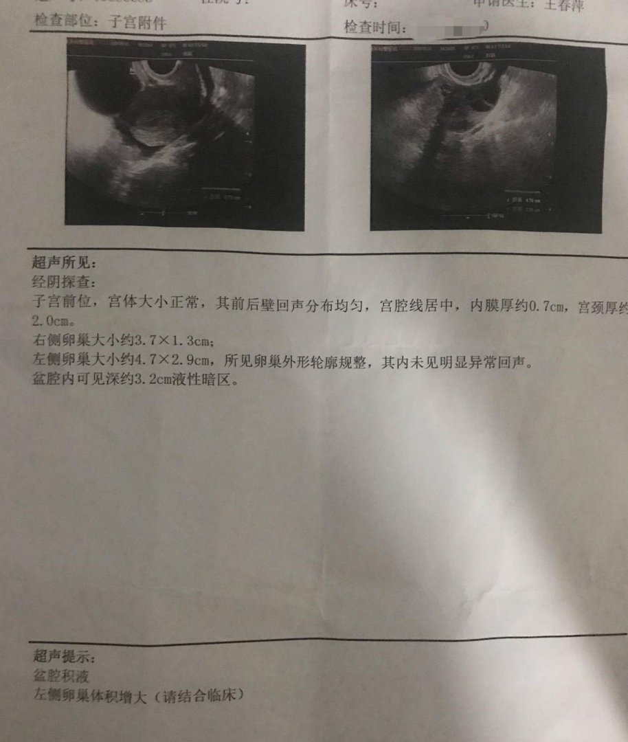 卵巢癌的症状都有哪些？