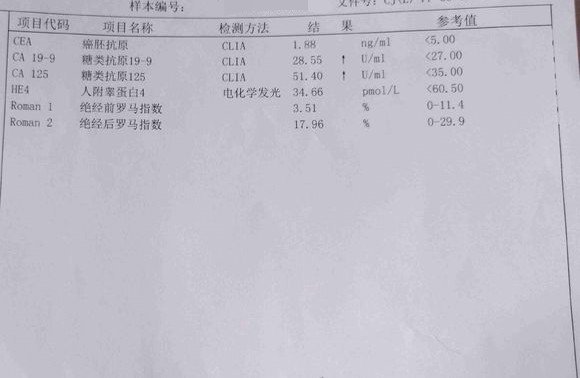 卵巢癌的症状都有哪些？