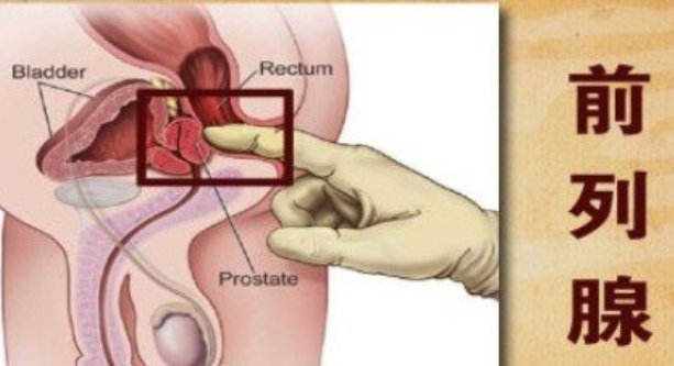 堵住铃口按压前列腺方法是什么？