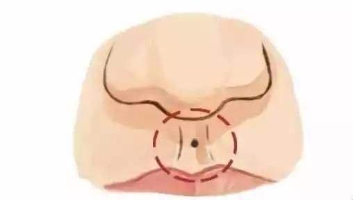 人中比较深代表什么