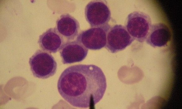 “suspection”和“suspicion”的区别是什么?